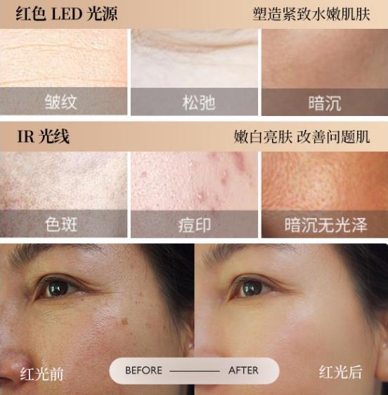 時光之謎美容儀,將光療抗衰新技術(shù)帶入百姓生活