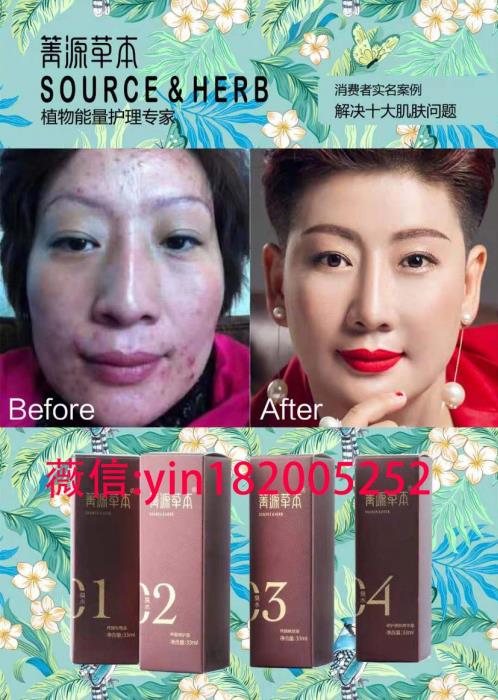 箐源草本臭水代理價格表,多少錢一盒?