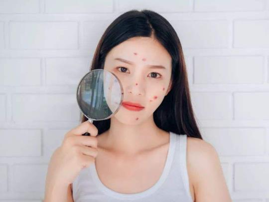 青春痘疫苗上市了嗎?青春痘疫苗多少錢一針