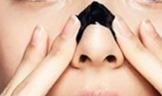 鼻尖上頑固的黑頭是每個人都有的煩惱 5個妙招快速去黑頭