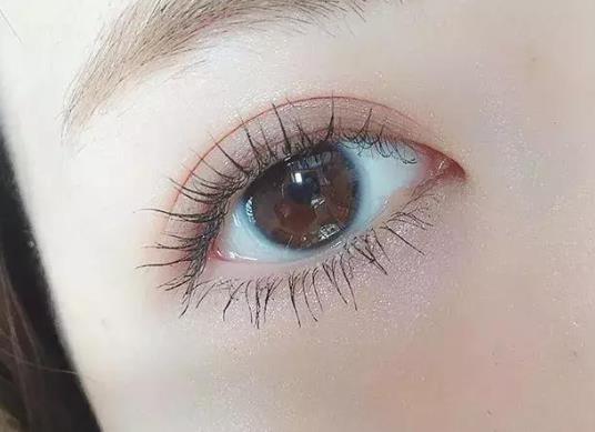 眼皮松弛能做雙眼皮嗎?全切雙眼皮幾年后會(huì)變自然?