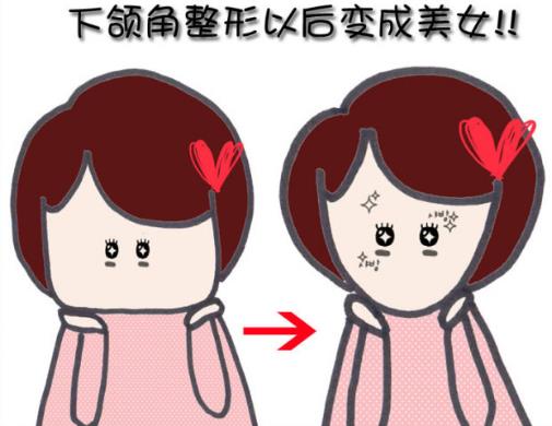 下頜角整形手術(shù)的適應(yīng)癥-下頜角整形手術(shù)的注意事項(xiàng)