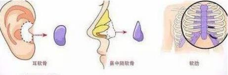 北京伊美爾醫(yī)療醫(yī)院:鼻唇溝是哪里