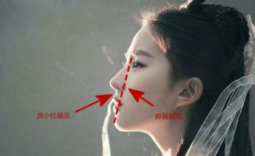 北京伊美爾醫(yī)療醫(yī)院:鼻唇溝是哪里