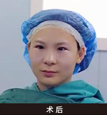 深圳美萊眼整形“雙杰”亮相2019中國眼整形高峰論壇