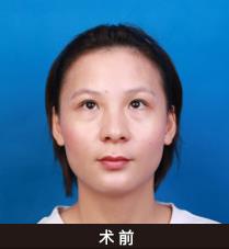 深圳美萊眼整形“雙杰”亮相2019中國眼整形高峰論壇