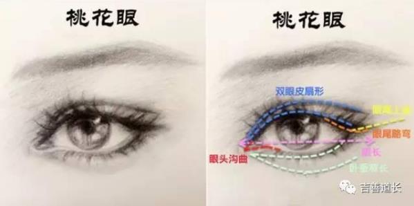 慈溪悅爾整形門診部做桃迷眼雙眼皮太好看了吧