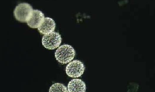 世界上最大的細(xì)菌 納米比亞珍珠硫細(xì)菌闊度有0.1-0.3毫米