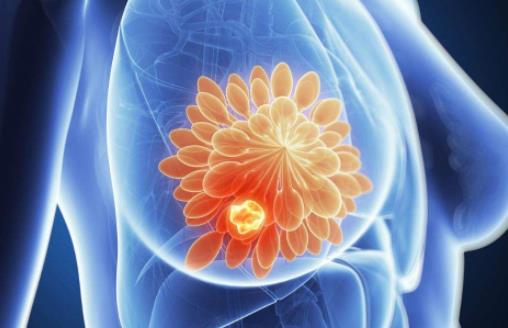 乳腺增生對(duì)懷孕有沒有影響 乳腺增該吃的3種食物
