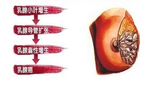 乳腺增生對(duì)懷孕有沒有影響 乳腺增該吃的3種食物