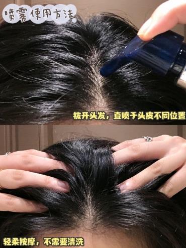 海飛絲去屑效果怎么樣?