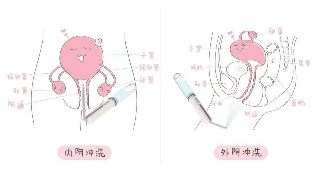 女人陰道是什么樣子的圖片科普 陰部真實(shí)構(gòu)造解剖結(jié)構(gòu)圖