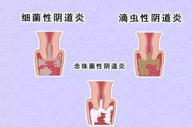 女人下面是什么樣子的圖片 陰部真實(shí)構(gòu)造解剖結(jié)構(gòu)圖