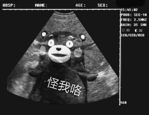 孕婦奶粉哪個(gè)品牌好 選對(duì)這個(gè)沒(méi)煩惱
