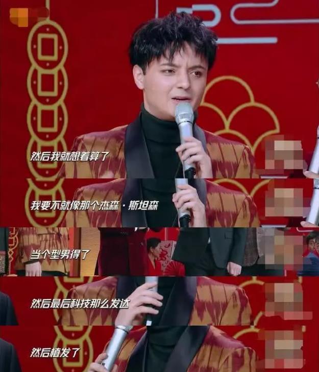 禿然長大是什么意思?童星阿爾法19歲謝頂21歲植發(fā)成功分享經(jīng)歷
