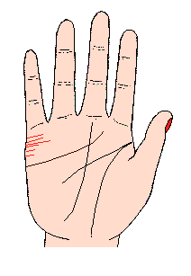 結(jié)合線很短又不規(guī)則，而且很多條