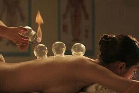 拔火罐能減肥嗎？拔火罐減肥的壞處
