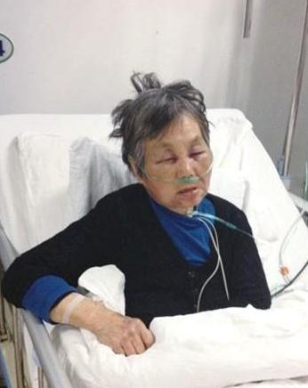 教授醉酒耍酒瘋殘忍毆打7旬老人令人發(fā)指，被打老人昏迷大小便失禁