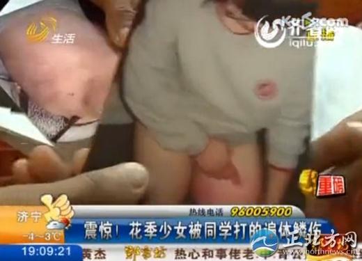 16歲花季少女被四名室友毆打4小時(shí)，脫光了跪在地上打，打得遍體鱗傷