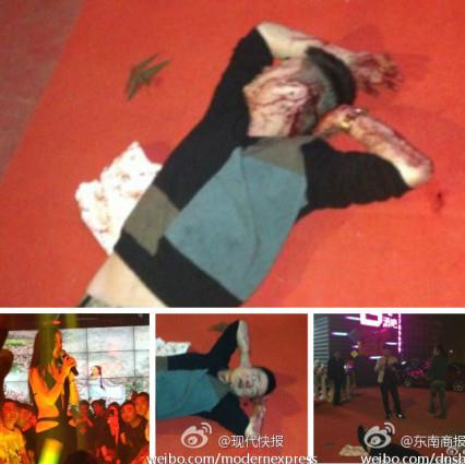 干露露宜興酒吧違規(guī)走穴又惹亂子，男子拉扯干露露被群毆(圖)