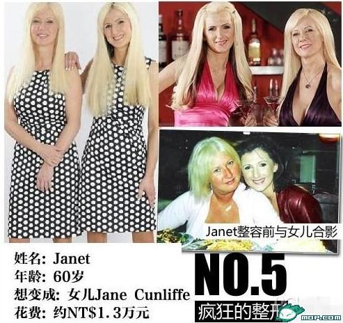 坑爹時代：那些奇葩的瘋狂變臉整容，坑爹呀