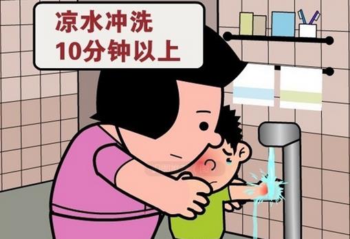 被開(kāi)水燙傷怎么辦？應(yīng)急措施介紹