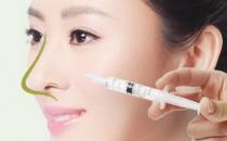 注射隆鼻具體有什么優(yōu)勢(shì)