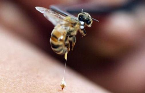 被蜂蜇了怎么辦？被蜂蜇的急救方法