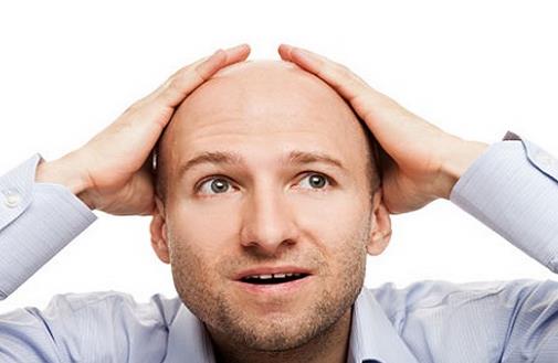 禿頂?shù)脑?七個(gè)習(xí)慣防止男人禿頂