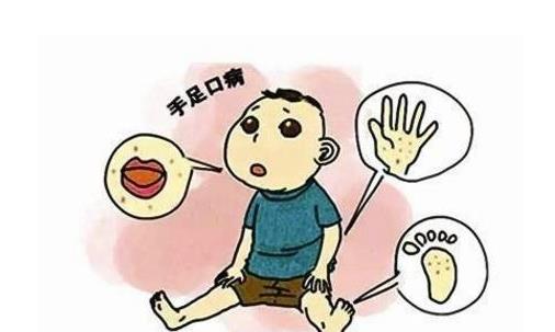 什么是手足口病?手足口病怎么治療