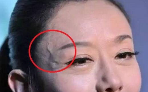身上青筋凸起預(yù)示疾病風(fēng)險(xiǎn) 青筋暗示心血管疾病前兆