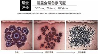 寧波薇琳整形醫(yī)院祛斑怎么樣？還您一張漂亮的容顏