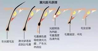 寧波薇琳整形醫(yī)院祛斑怎么樣？還您一張漂亮的容顏