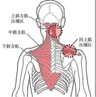 湛江崇愛康復(fù)醫(yī)院科普如何防治肌筋膜炎 以真誠來服務(wù)患者