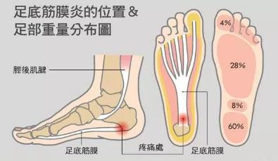 湛江崇愛康復(fù)醫(yī)院科普如何防治肌筋膜炎 以真誠來服務(wù)患者