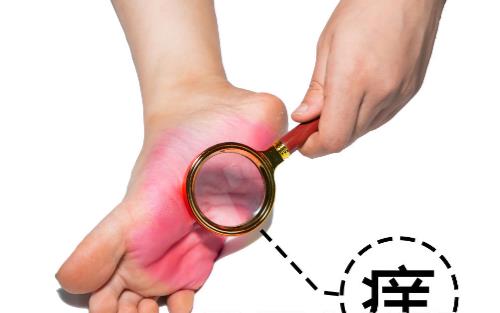 有腳氣的人，經(jīng)常用鹽水泡腳就能消滅真菌嗎？它沒有這個