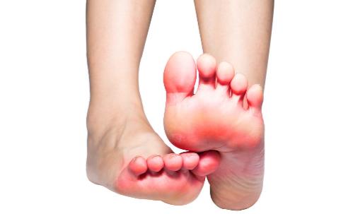 有腳氣的人，經(jīng)常用鹽水泡腳就能消滅真菌嗎？它沒有這個