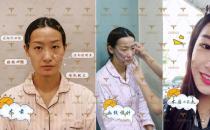 自體多肽脂肪實現(xiàn)新突破，塑造無法復(fù)制的自然美