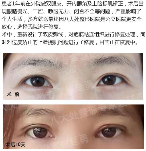八大處整形趙延勇眼修復怎么樣 用實力鑄就業(yè)內(nèi)口碑