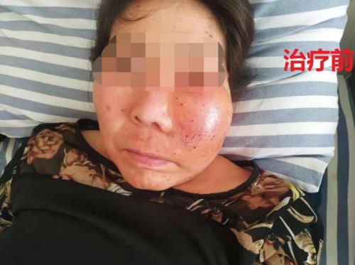 鄭州京美醫(yī)院腫瘤科好嗎？中醫(yī)專家 微創(chuàng)聯(lián)合治療