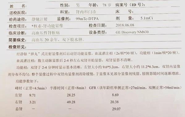 青島靜康醫(yī)院案例：明明是重度腎衰,血肌酐卻正常!化驗(yàn)單會(huì)說謊嗎?