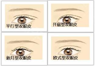 八大處整形楊欣：割了雙眼皮還不好看怎么辦