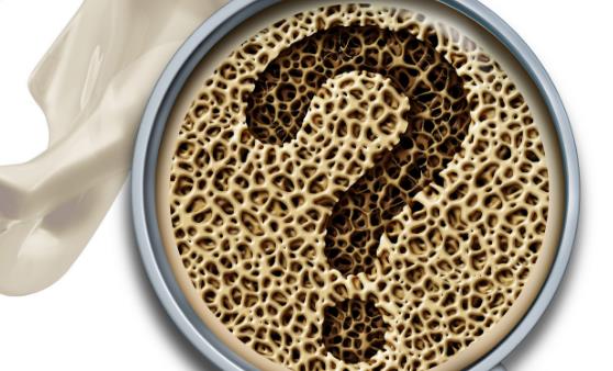 骨質(zhì)疏松的10個(gè)認(rèn)知誤區(qū)，你中了沒(méi)？