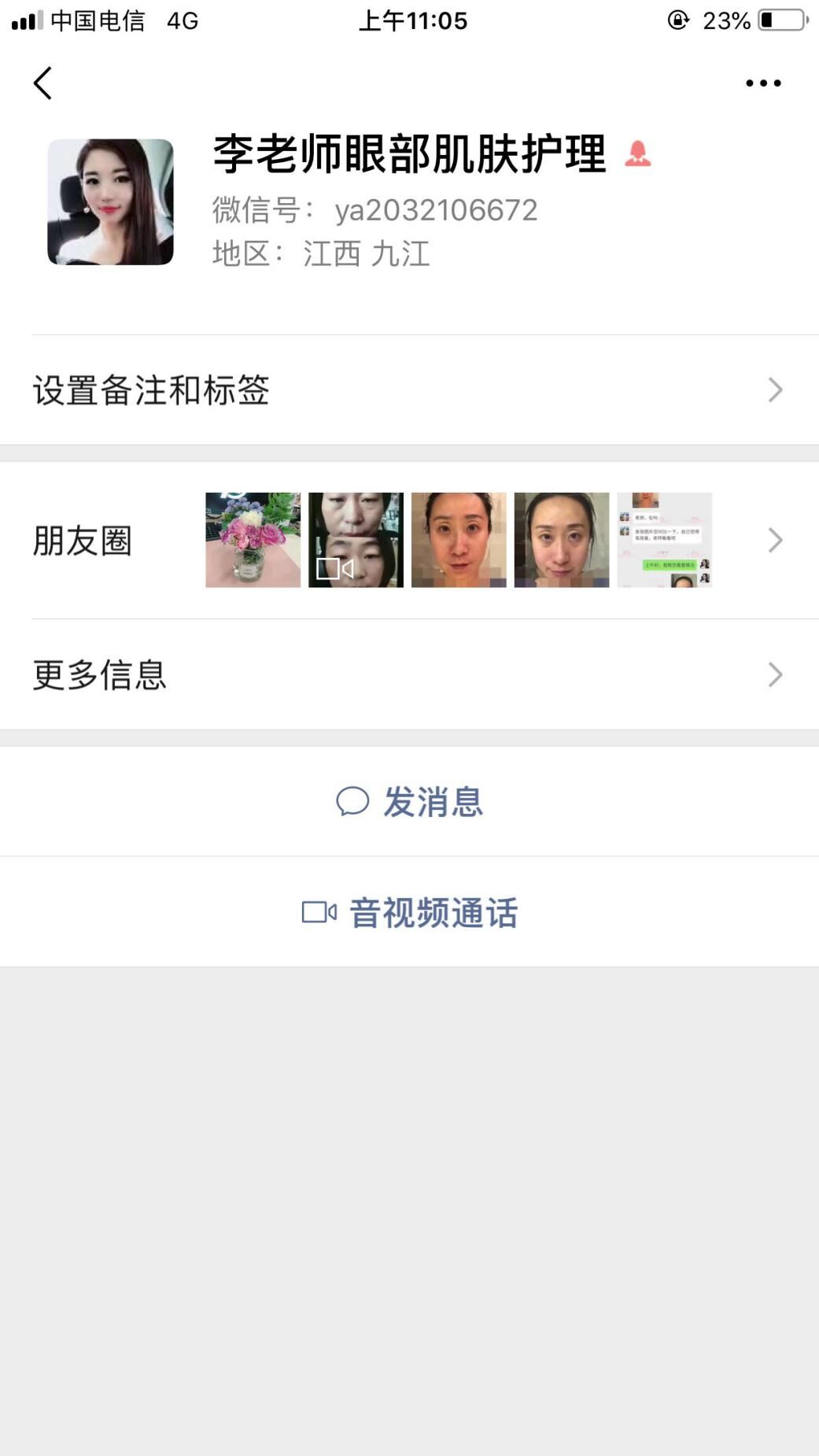衛(wèi)婭日記：我一直都以為眼袋對我的影響只是美觀，直到我了解了以后……