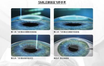 西安普瑞眼科醫(yī)院治療近視好？參軍入伍，近視手術(shù)提前半年做準(zhǔn)備