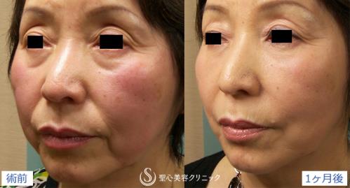 圣心醫(yī)療美容鐮倉達郎總院長，帶你探索年輕的秘密