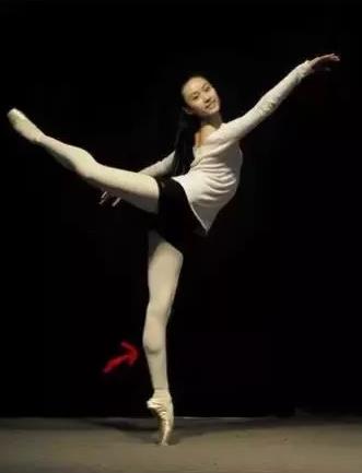 上海麗質(zhì)美學(xué)整形門(mén)診部做瘦小腿價(jià)格貴嗎？肌肉小腿太難減怎么辦