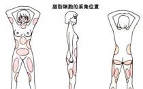 韋元強：產(chǎn)后能做自體脂肪豐胸嗎？