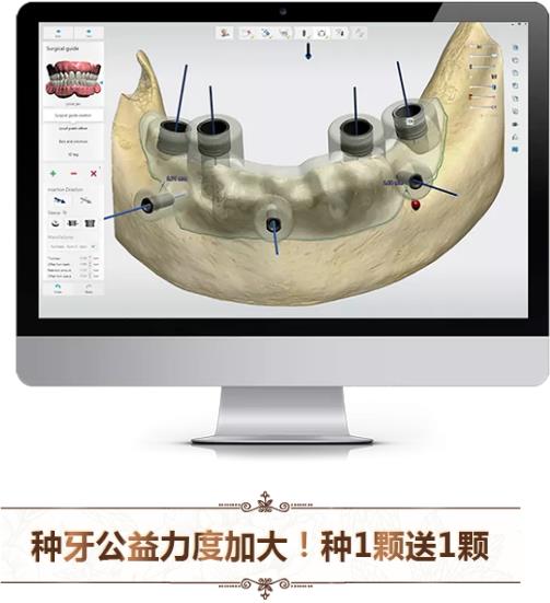中家醫(yī)口腔全民愛牙公益行動(dòng)：德國(guó)智能種植牙更靠譜