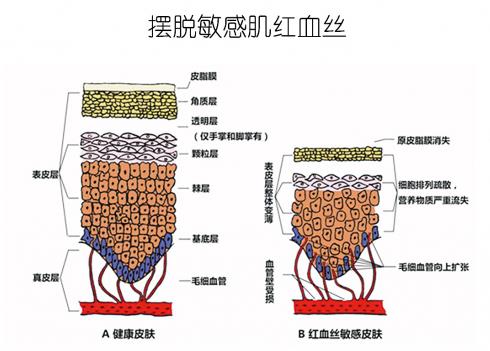 放心！有美薏升修復(fù)敏感肌紅血絲專家產(chǎn)品在，你每天都可以美美噠